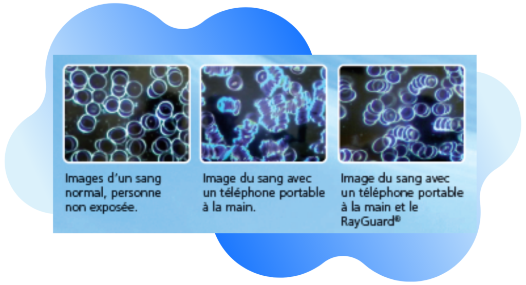 Protection ondes Ray Guard